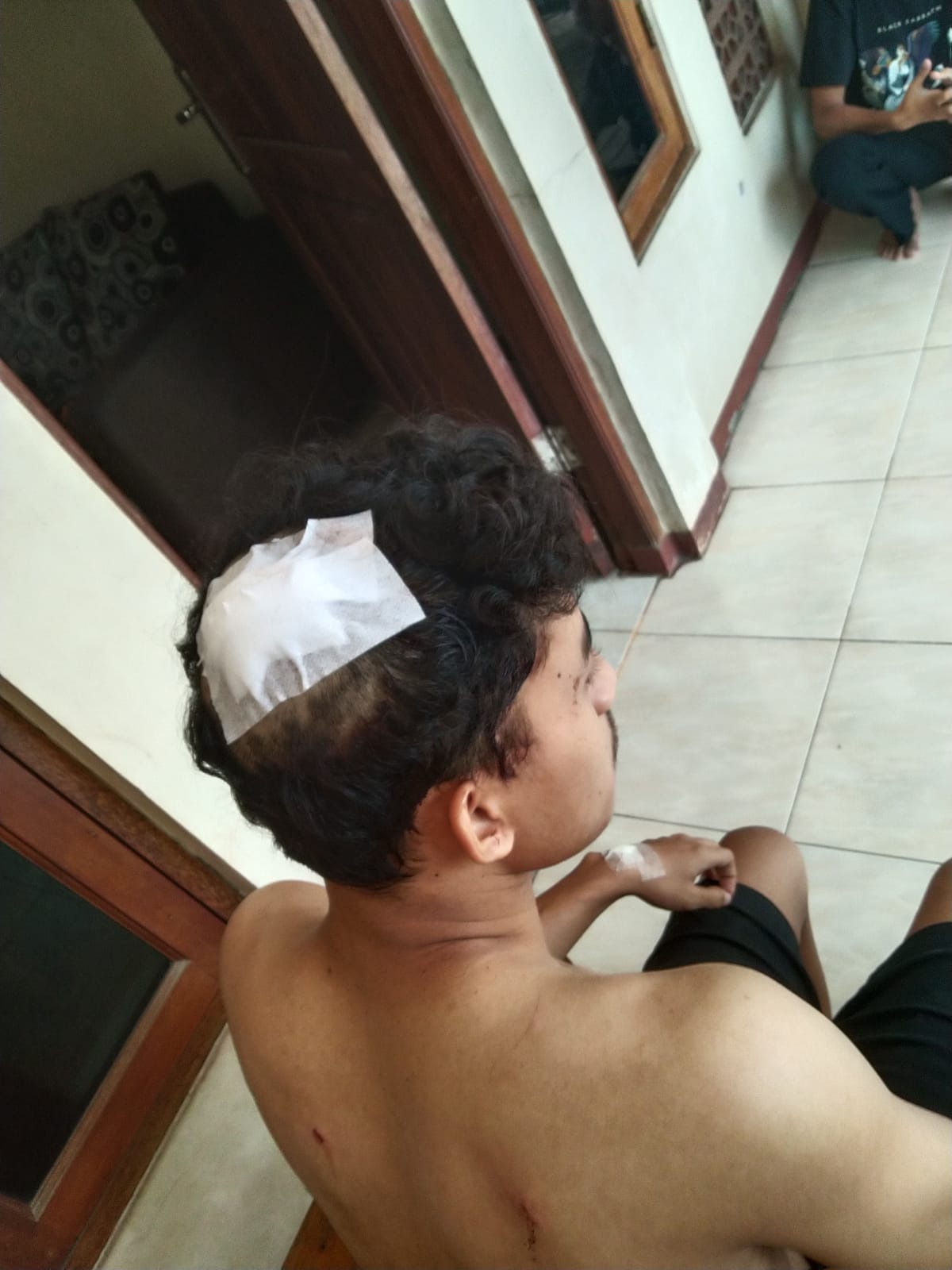 Begal Rampas Motor di Tangsel, Korban Terluka Disabet Celurit