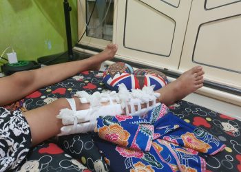 Siswi di Tangerang Jadi Korban Bullying hingga Patah Kaki, Kini Terbaring Lemas