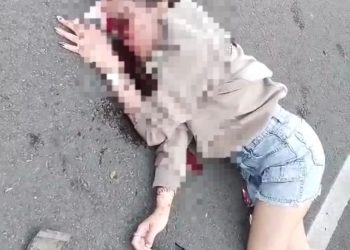 Kecelakaan Tunggal di BSD Serpong, Gadis Muda Luka Parah di Wajah