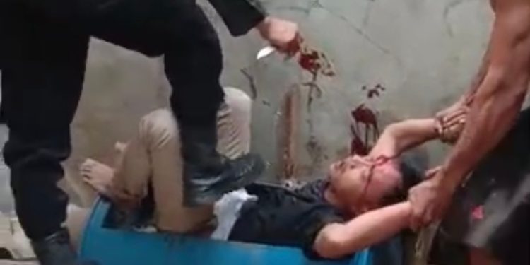 Aksi Heroik Iptu Gunawan, Polisi yang Luka 27 Jahitan Usai Bergumul Ringkus Pelaku Ganjal ATM